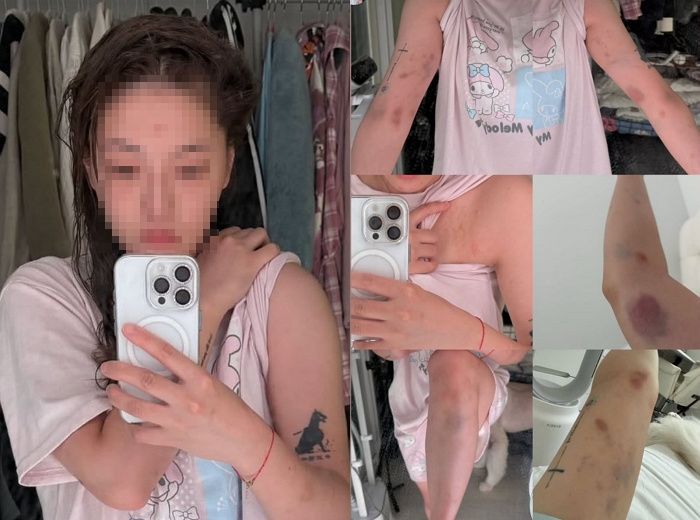 하룻밤 보내자 거절한 대만 여성, 홍대서 무참히 폭행 당했다