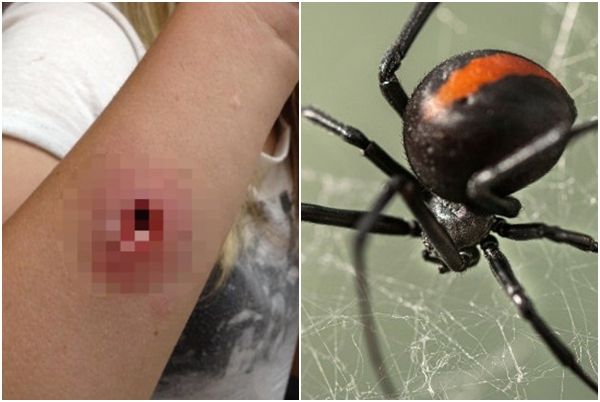 호기심에 만지면 큰일⋯극심한 통증 일으키는 '이것' 뭐길래