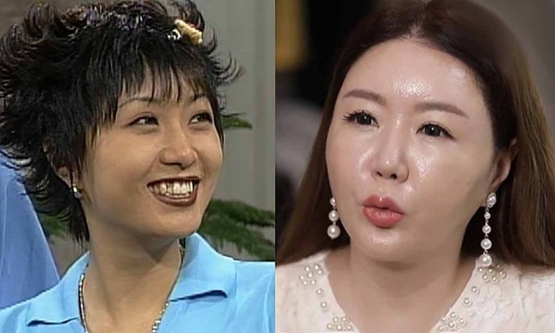 뇌종양 투병한 배우 이의정, 15년 만에 완치 소식