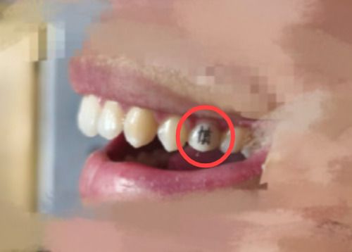 멋져 보여서 선택... 중국서 유행하는 문신의 정체