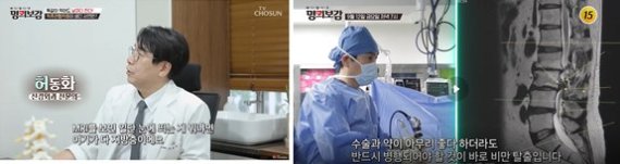 (사진설명) ▲ 청담해리슨병원 허동화 원장 (사진=TV조선 ‘명의보감’ 캡처)
