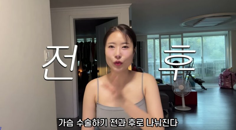 이세영 내 삶 가슴수술 전후로 나뉘어…A에서 D컵, 만족도 2000%