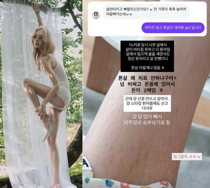 바카라사이트 벳무브가 튼살을 공개했다. 사진=바카라사이트 벳무브 인스타그램