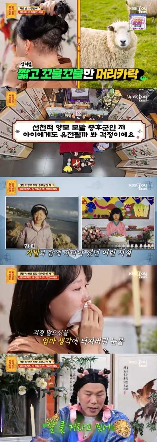 "5살 때부터 29년째 가발 써"…서장훈-이수근 안타까움