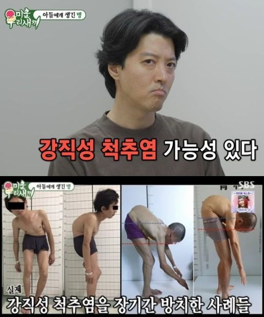 눈 충혈로 병원 찾은 이동건, 뜻밖의 병 진단 받아... 무슨 일?