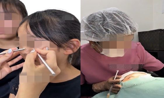 사랑에 빠진 10세 여아, 쌍꺼풀 수술 日병원 선 넘은 홍보