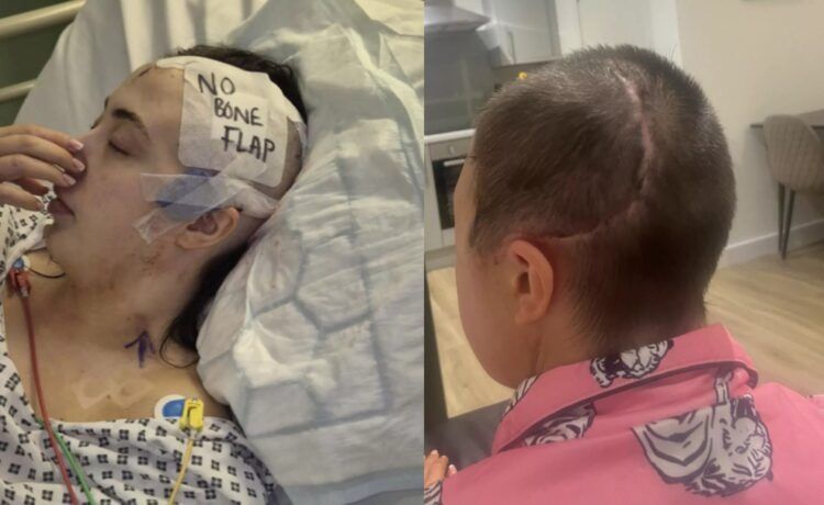 술 먹고 계단서 구른 24세女, 참혹한 결말 