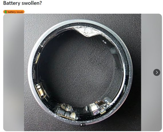 "손 부기 빼고 윤활제 발라 뺐다"…부풀어 오른 '갤럭시 링' 끝내