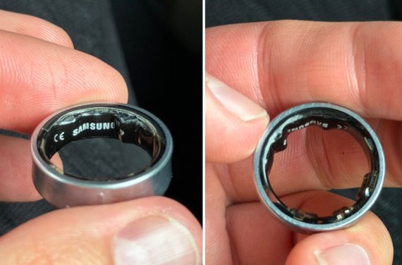 손 부기 빼고 윤활제 발라 뺐다…부풀어 오른 '갤럭시 링' 끝내