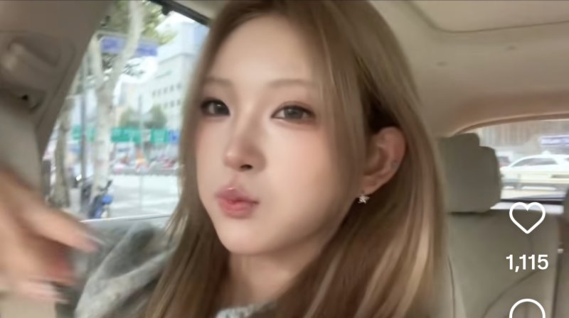 최준희, 입술 필러 녹이고 달라진 외모…더 예뻐져
