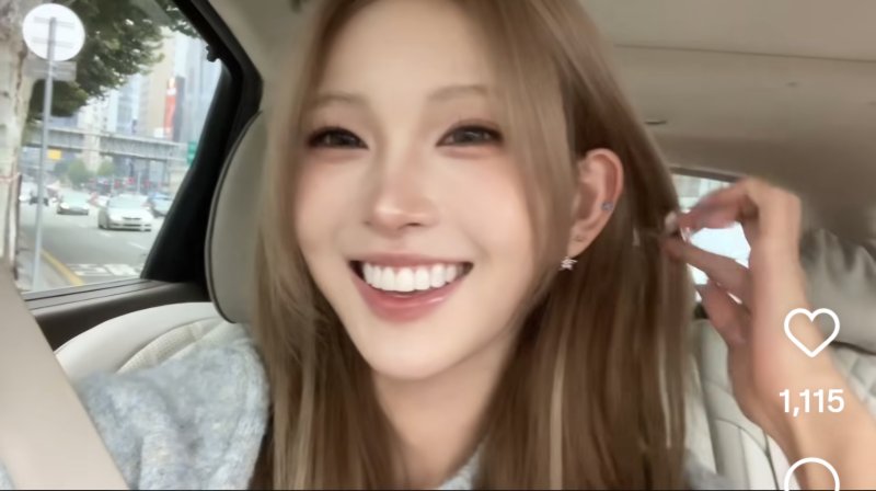 최준희, 입술 필러 녹이고 달라진 외모…더 예뻐져