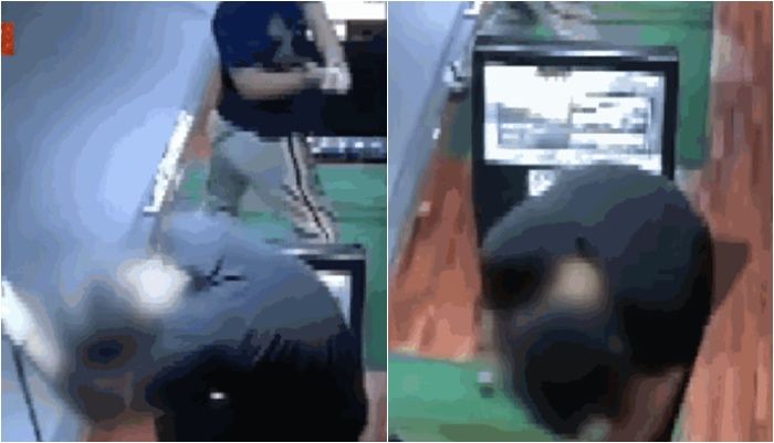 '백스윙' 맞고 이마 6cm 찢어졌는데…"해줄 수 있는 게 없다" 분노