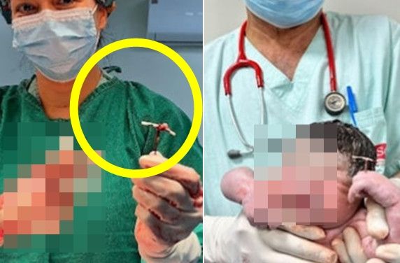 갓 태어난 아기 손에 들린 '이것'…99% 피임 효과 뚫은 이유가