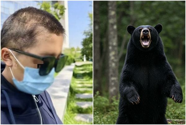 죽은 척하고… 흑곰에 머리 물린 임신부가 살 수 있던 까닭 