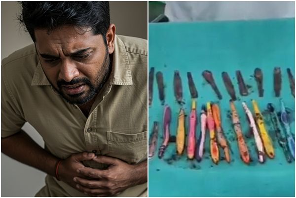 숟가락 29개, 칫솔 19개, 펜 2개... 사람 뱃속에 나온 것들이라고?