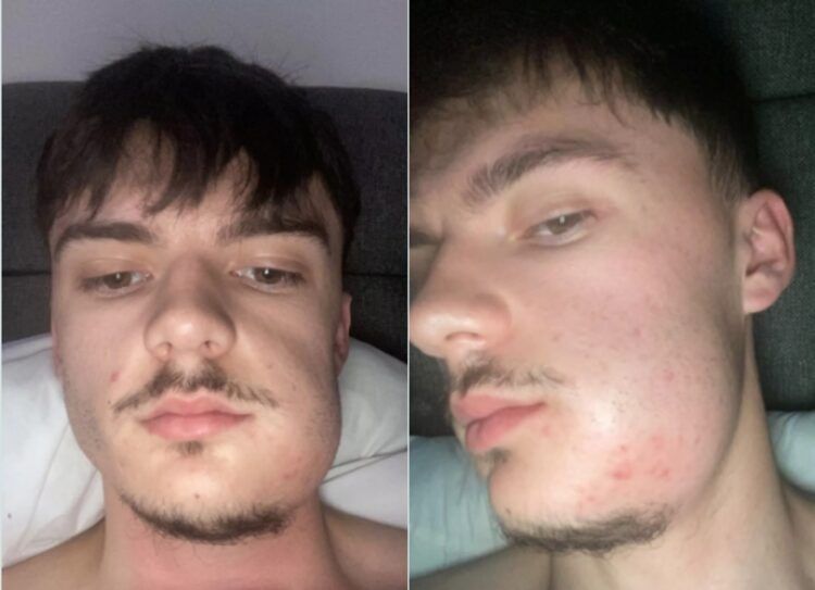 내 얼굴 왜 이래 치아에 있는 '이것' 때문