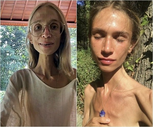 과일만 먹던 20대가 맞이한 비극적인 결말 "너무 끔찍"