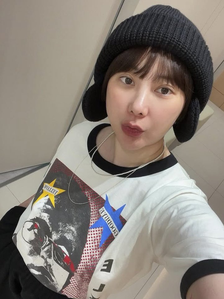 서인영, 10㎏ 체중 증가·코 보형물 제거 고백 "원래 38㎏인데 쪘다"