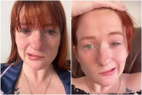 출산 10일 만에 얼굴 마비된 女, 병원 가보니 병명이..