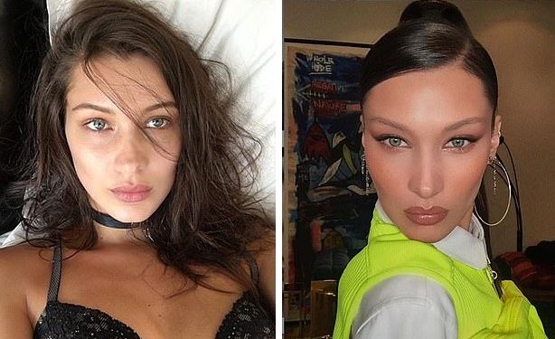 '여우 눈' 시술 받은 후 숨진 유명 인플루언서