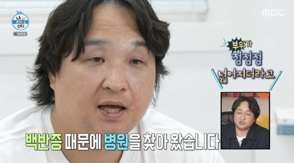 구성환, 난치성 질환 백반증 고통…"부위 점점 넓어져" [RE:TV]