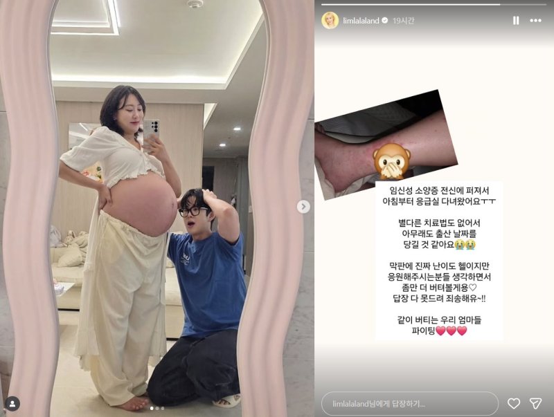'손민수♥' 임라라 임신성 소양증으로 응급실…출산 날짜 당길 듯 