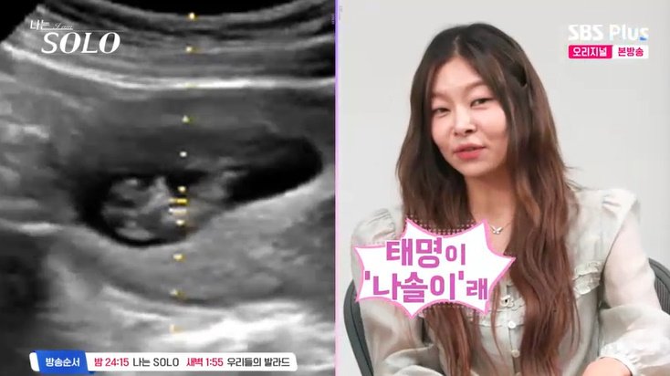 '나는 솔로' 사상 초유 '혼전 임식' 소식…"엄마 아빠 누구?"