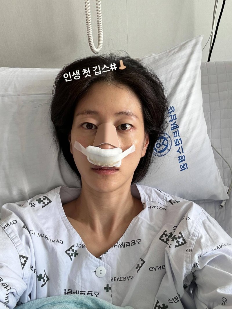 이현이, 축구하다 코뼈 골절…의욕 앞서, 인생 첫 깁스