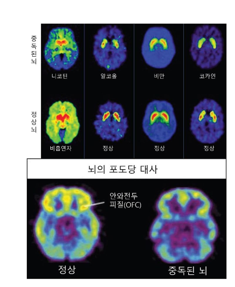 뇌가 보내는 SOS, 도파민 중독의 함정에서 벗어나기 [안철우 교수의 호르몬 백과사전]