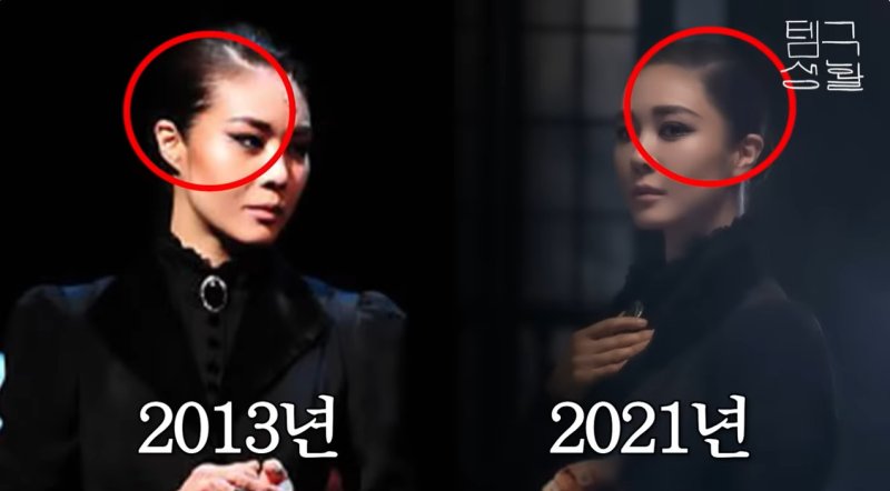 옥주현, 탈모+모발이식 고백 잔머리 사라져 스트레스