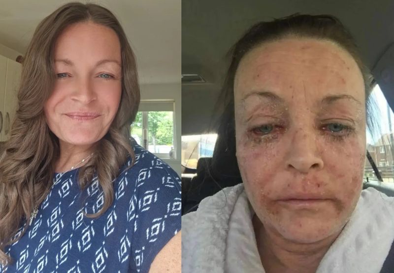 토하면서 술 마신 46세 여성의 고백 살기 위해 마셨다