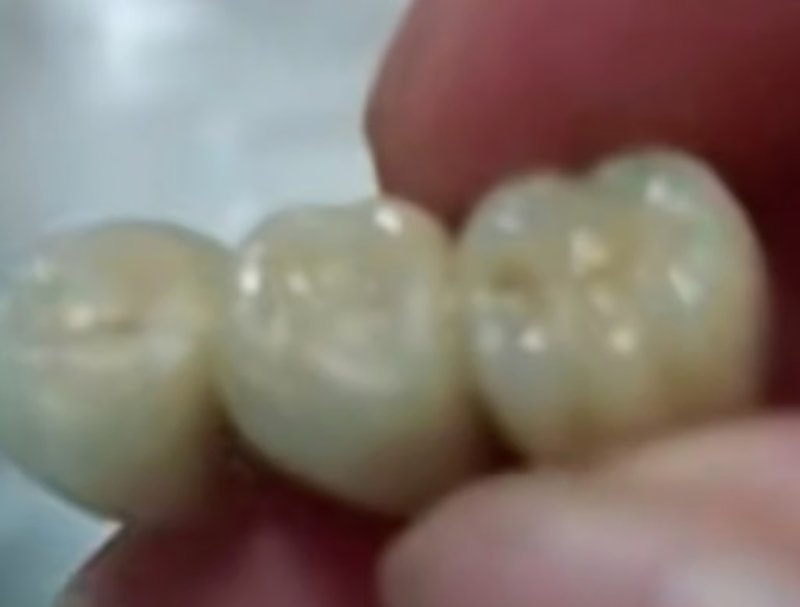 딤섬 먹다가 뭐가 씹히길래 뱉었더니... 끔찍한 실화