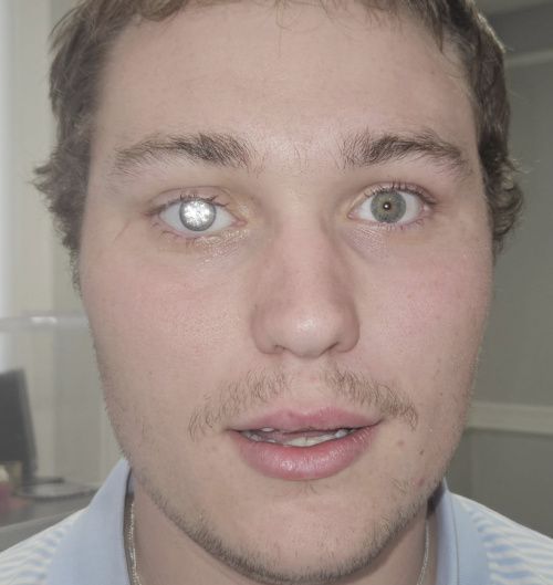 29억 짜리 '다이아몬드 눈' 제작한 20대 화제