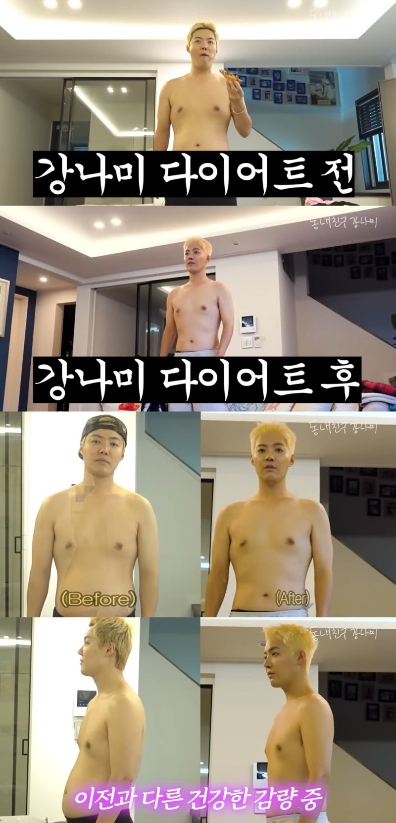 돈새는 콧구멍 강남, 13㎏ 감량에 코 재수술…확 달라진 옆선 [N이슈]