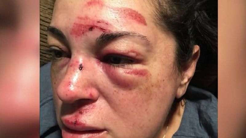 길 가다 넘어졌을 뿐인데 보상금 '106억'... 무슨 일?