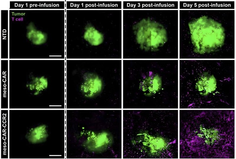 3차원 칩에서의 CAR-T 세포 치료 효과 관찰 (출처=연합뉴스)