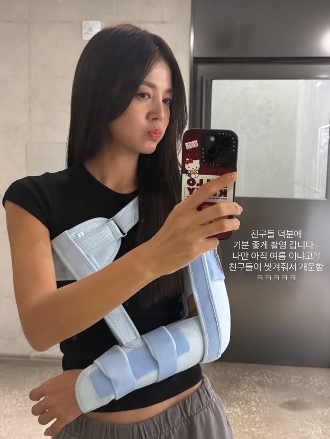 김성은, 활동 뜸하더니 부상 소식 "친구들이 씻겨줘"