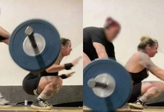 30대女, 120kg 들고 '이것' 하다가, 양 발목 그만…'헉'