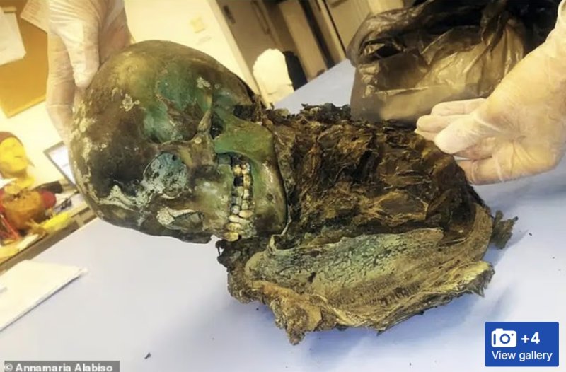 [서울=뉴시스] 이탈리아 볼로냐에서 발견된 '초록색 미라'. 연구진들은 구리 상자 속에 묻혀 있던 시신이 세월이 흐르며 구리 이온과 반응해 뼈와 피부가 선명한 에메랄드 빛으로 변한 것으로 분석했다. (사진출처: 데일리메일 홈페이지 캡처) 2025.11.03.
