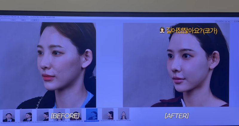 '환승연애2' 이나연, 코 재수술 결정…성형 전후 공개