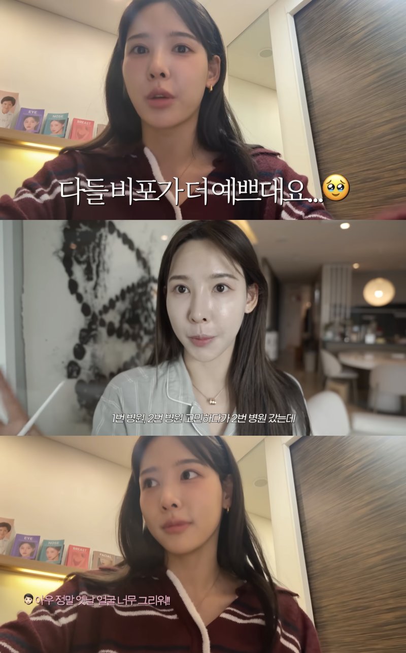 '환승연애2' 이나연, 코 재수술 결정…성형 전후 공개