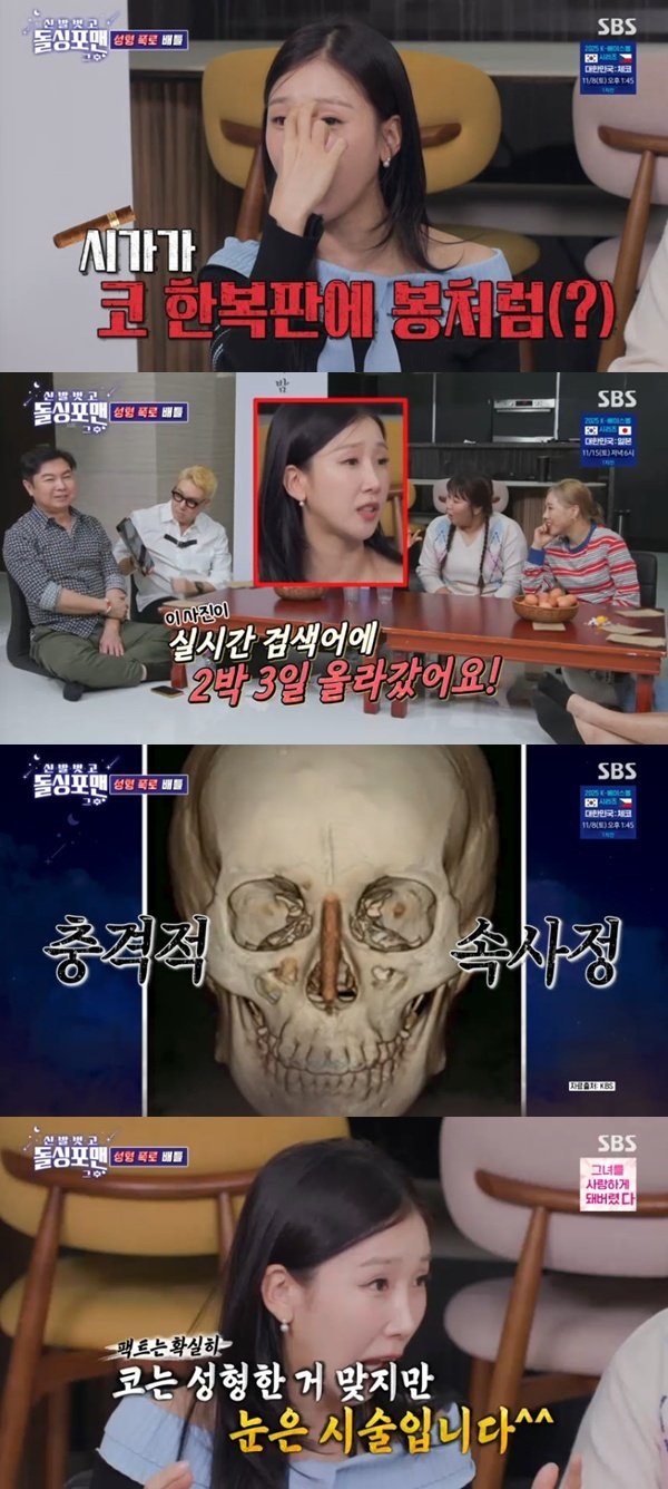 박소영 코 성형으로 실검 2박 3일 장악…눈은 시술 [RE:TV]