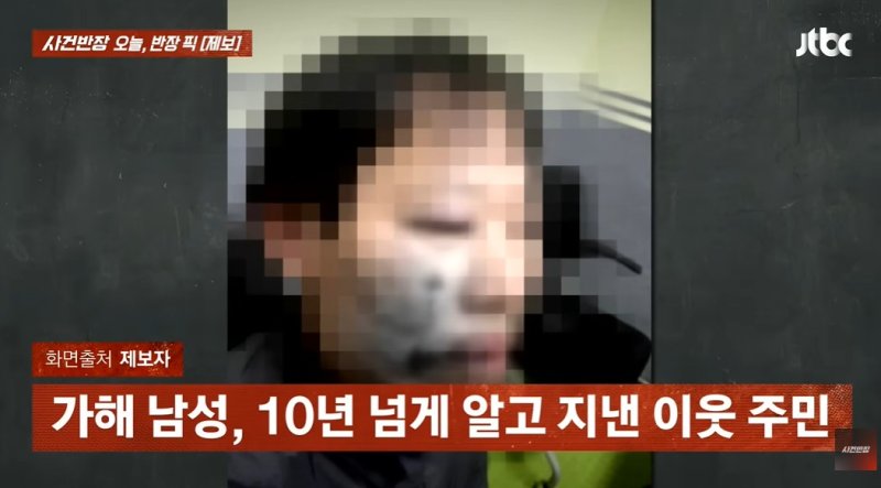 [뉴시스]전치 4주 부상을 입은 제보자의 모습. (사진 = JTBC 사건반장 캡처) *재판매 및 DB 금지