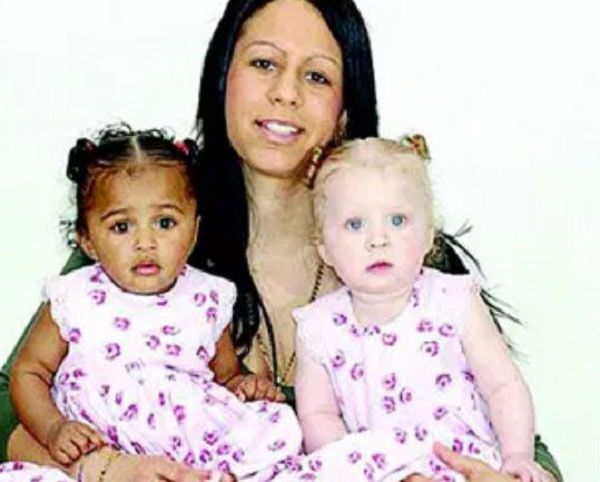 쌍둥이인데 아버지가 다르다.. 어떻게 가능하지?