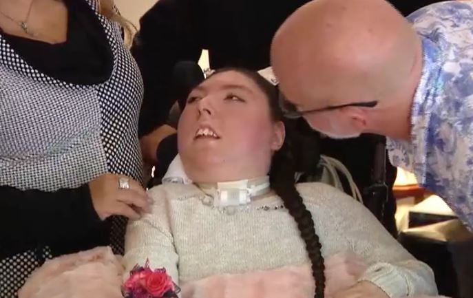 뇌 없이 태어난 女, 20살 생일 맞았다