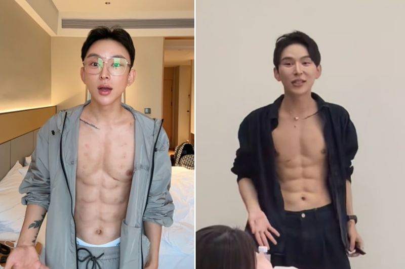 '에잇팩' 만들려고 필러 주입한 男, 쓴 돈이 무려..