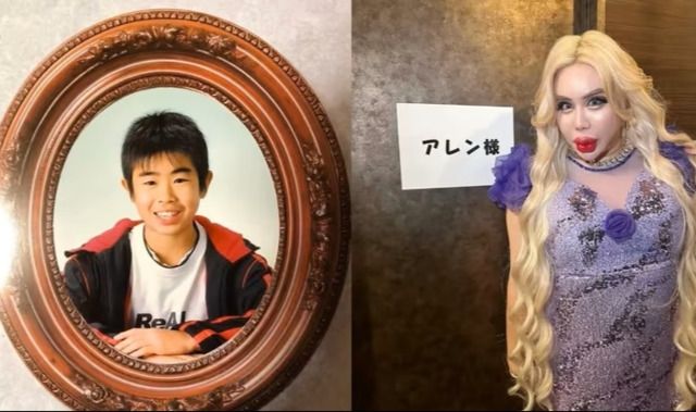 '왕따' 남성, 200회 전신 성형 수술.. 비용이 무려