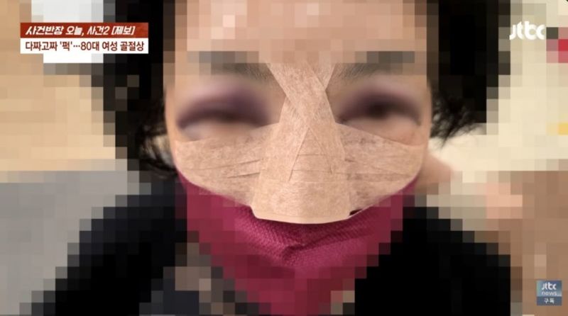 행인 무차별 폭행한 30대, 피해자 수술에도 가해자父는..