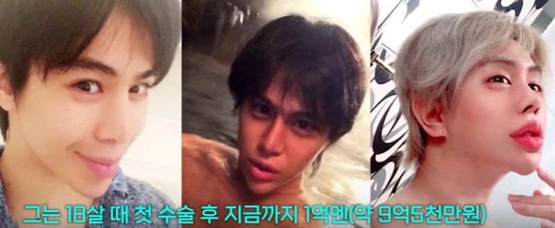 일본의 한 남성이 약 10억 원에 달하는 돈을 들여 전신 성형을 한 사연이 공개돼 화제다. 사진=홍콩 사우스차이나모닝포스트 갈무리