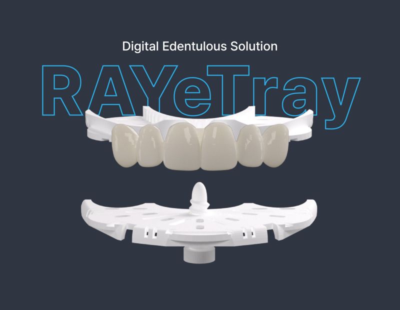 레이, 무치악 디지털 솔루션 'RAYeTray' 미국 FDA 인증